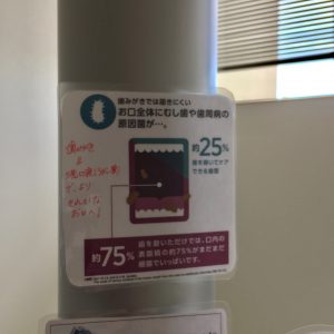 洗口液のメリット